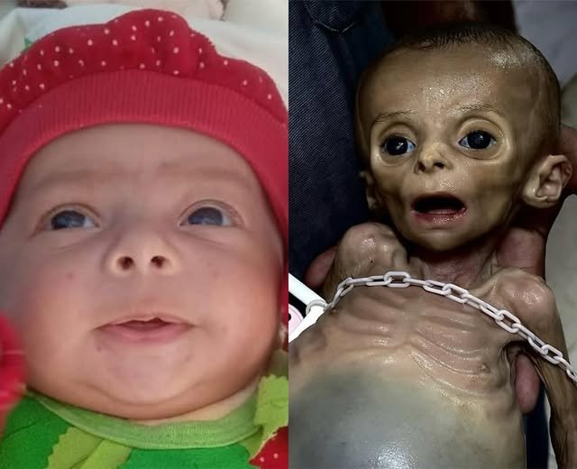 The deliberate starvation of Gazans